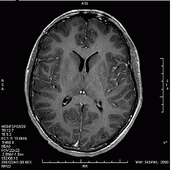Ilustracja do odpowiedzi D