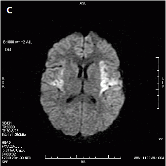 Ilustracja do odpowiedzi A