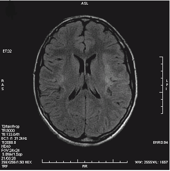 Ilustracja do odpowiedzi B