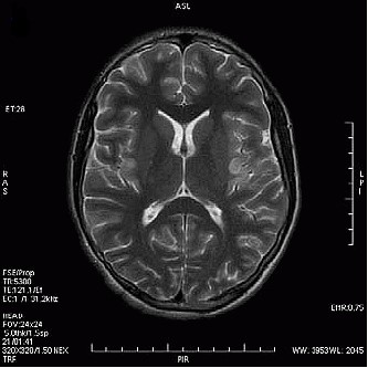 Ilustracja do odpowiedzi C