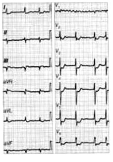Ilustracja do pytania 7