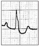 Ilustracja do odpowiedzi A
