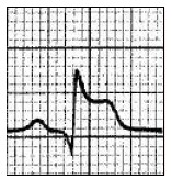 Ilustracja do odpowiedzi B