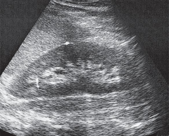 Ilustracja do pytania 29