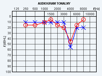 Ilustracja do pytania 27