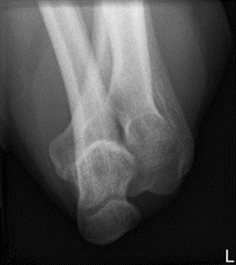 Ilustracja do pytania 10