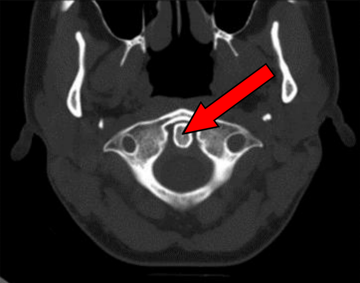 Ilustracja do pytania 40