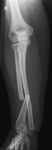 Ilustracja do pytania 34