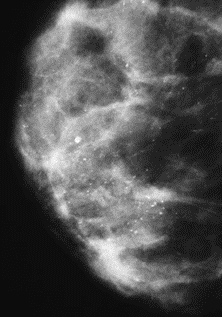 Ilustracja do odpowiedzi D