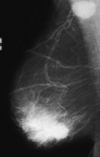 Ilustracja do odpowiedzi A