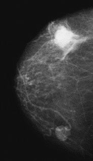 Ilustracja do odpowiedzi B