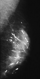 Ilustracja do odpowiedzi C