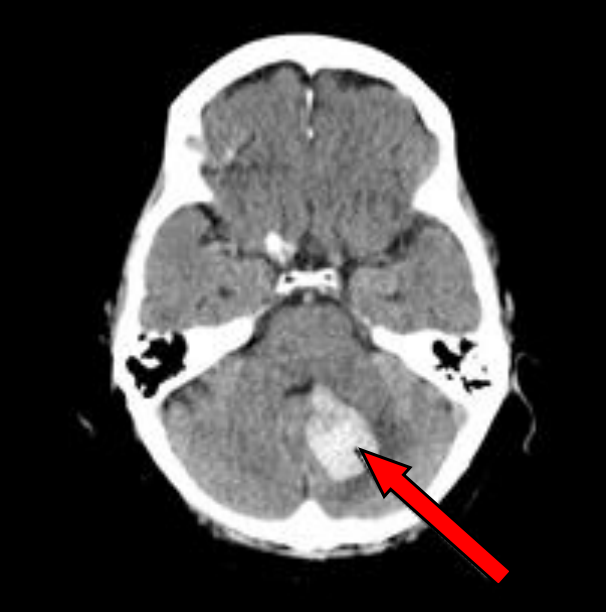 Ilustracja do pytania 40