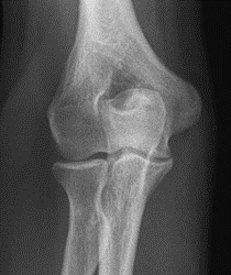 Ilustracja do odpowiedzi B