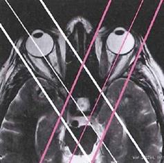 Ilustracja do odpowiedzi B