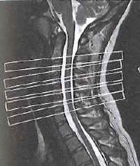 Ilustracja do odpowiedzi D