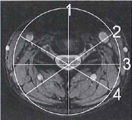 Ilustracja do odpowiedzi C