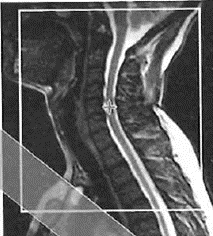 Ilustracja do odpowiedzi A