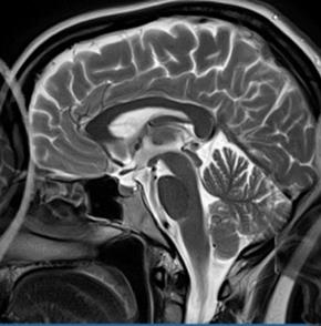 Ilustracja do pytania 39