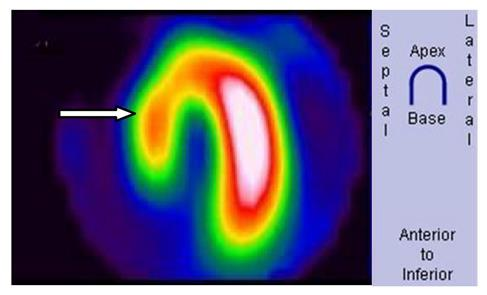 Ilustracja do pytania 32