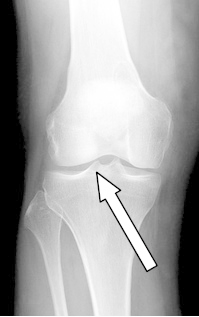 Ilustracja do pytania 7