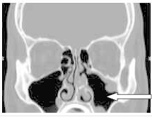 Ilustracja do pytania 16