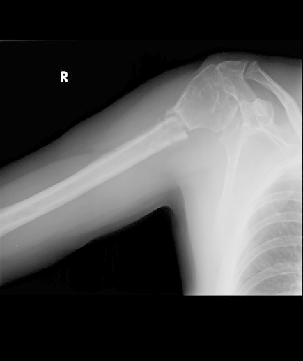 Ilustracja do pytania 2