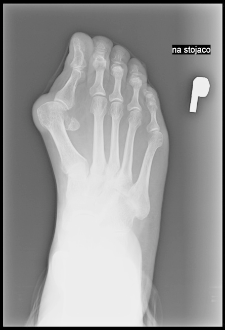 Ilustracja do pytania 11