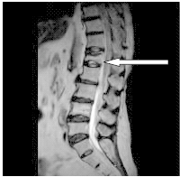 Ilustracja do pytania 37