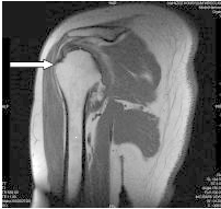 Ilustracja do pytania 10