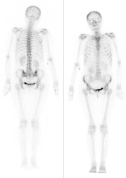 Ilustracja do pytania 22