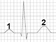 Ilustracja do pytania 3