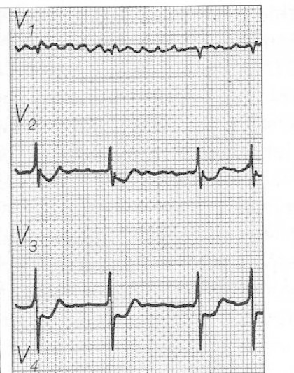 Ilustracja do pytania 16