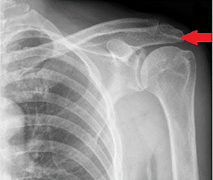 Ilustracja do pytania 36