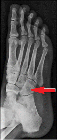 Ilustracja do pytania 5