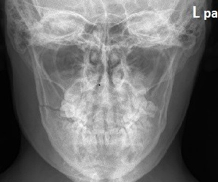 Ilustracja do pytania 18