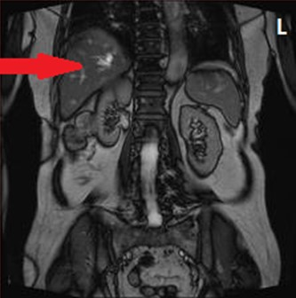 Ilustracja do pytania 35