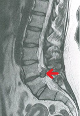Ilustracja do pytania 21