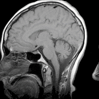 Ilustracja do pytania 2