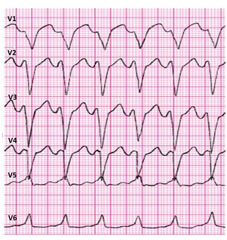 Ilustracja do pytania 14