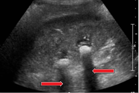 Ilustracja do pytania 4