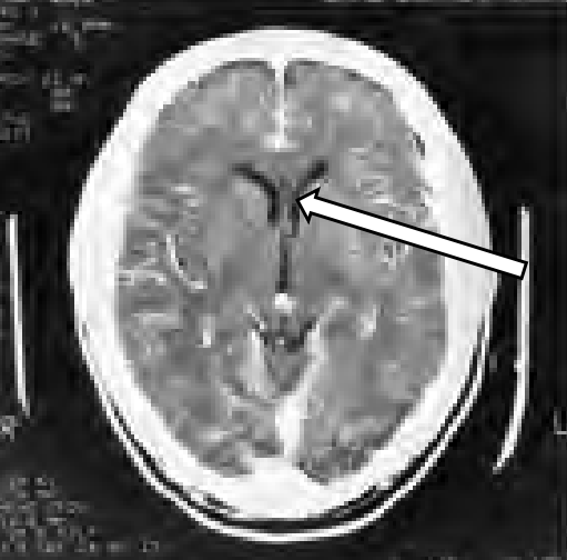Ilustracja do pytania z kwalifikacji MED.08