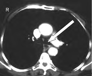 Ilustracja do pytania 23