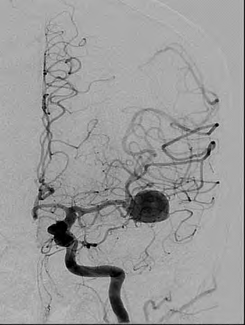 Ilustracja do pytania 39