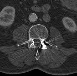 Ilustracja do pytania 35