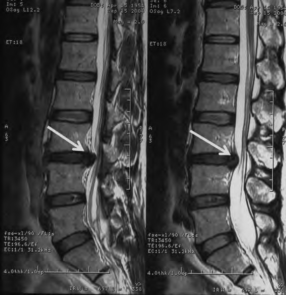 Ilustracja do pytania 13