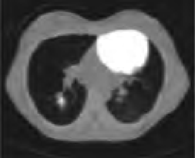 Ilustracja do odpowiedzi C