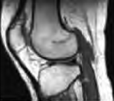 Ilustracja do odpowiedzi B