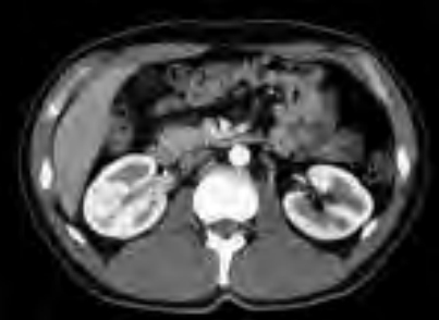 Ilustracja do odpowiedzi D