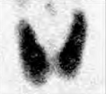 Ilustracja do odpowiedzi A